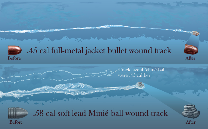 Ballistic gel wound tracks, .58 Minié and .45 fmj